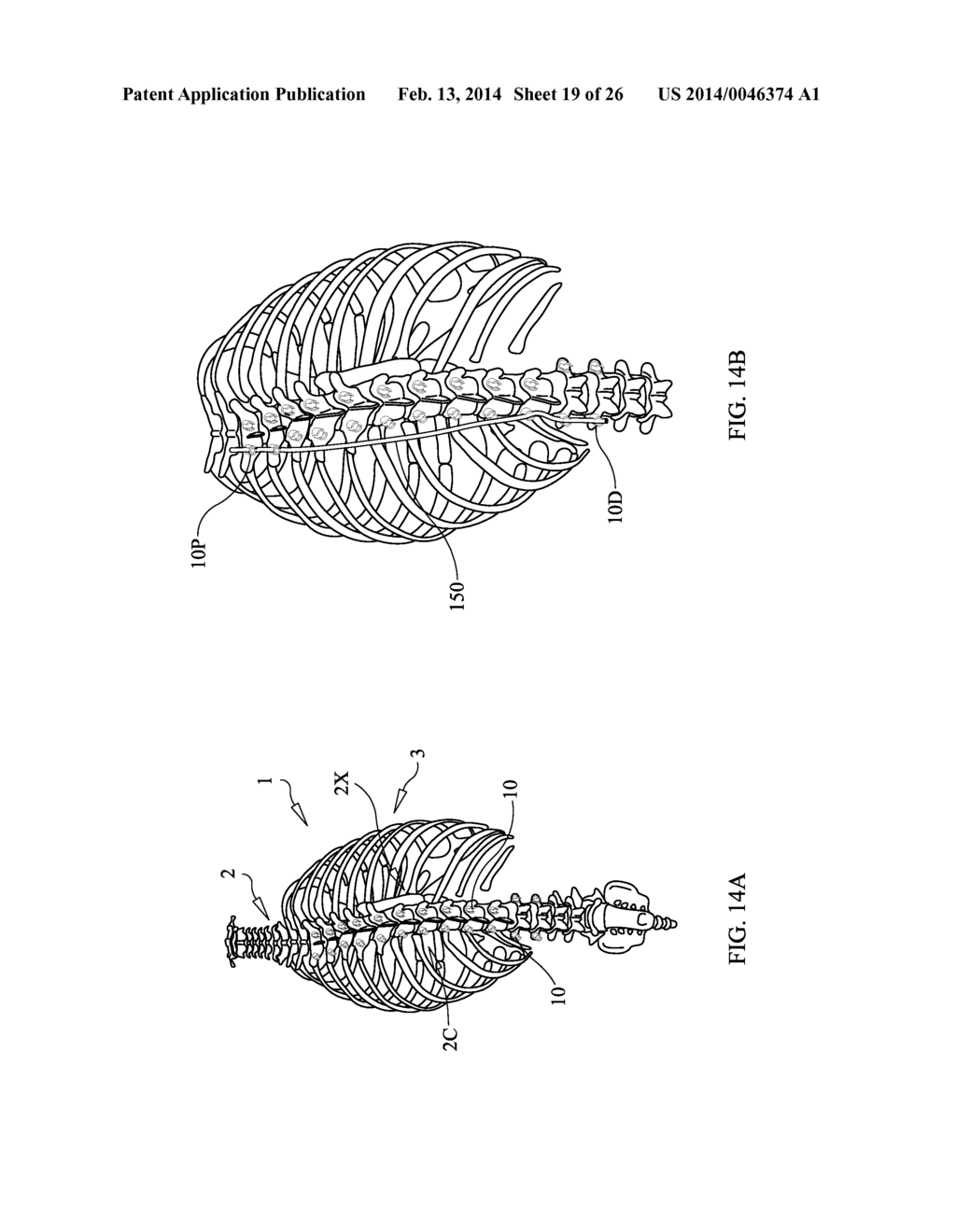 Staged Locking of Surgical Screw Assembly - diagram, schematic, and image 20