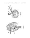 Staged Locking of Surgical Screw Assembly diagram and image