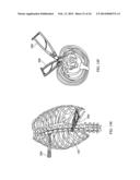 Staged Locking of Surgical Screw Assembly diagram and image