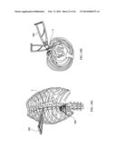Staged Locking of Surgical Screw Assembly diagram and image