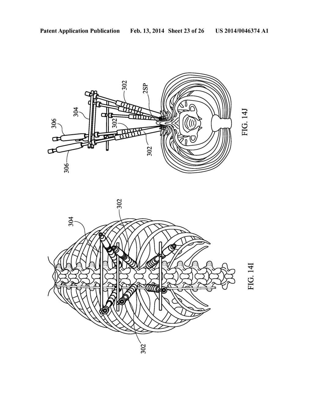 Staged Locking of Surgical Screw Assembly - diagram, schematic, and image 24