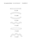 Bone Stabilization Device diagram and image