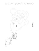 SCREW FOR JOINT FUSION diagram and image