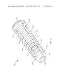 SYSTEM FOR JOINT FUSION diagram and image