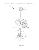 SYSTEM FOR JOINT FUSION diagram and image