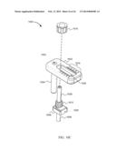 SYSTEM FOR JOINT FUSION diagram and image