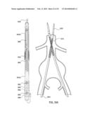 STENT DELIVERY SYSTEMS AND ASSOCIATED METHODS diagram and image