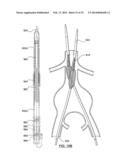 STENT DELIVERY SYSTEMS AND ASSOCIATED METHODS diagram and image