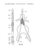 STENT DELIVERY SYSTEMS AND ASSOCIATED METHODS diagram and image