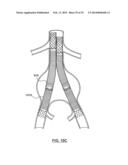 STENT DELIVERY SYSTEMS AND ASSOCIATED METHODS diagram and image