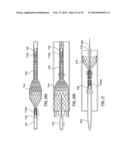 STENT DELIVERY SYSTEMS AND ASSOCIATED METHODS diagram and image