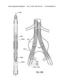 STENT DELIVERY SYSTEMS AND ASSOCIATED METHODS diagram and image