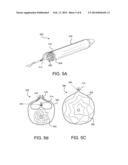 SLEEVES FOR EXPANDABLE MEDICAL DEVICES diagram and image