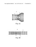 STENTED TRANSCATHETER PROSTHETIC HEART VALVE DELIVERY SYSTEM AND METHOD diagram and image