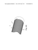 STENTED TRANSCATHETER PROSTHETIC HEART VALVE DELIVERY SYSTEM AND METHOD diagram and image