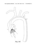 STENTED TRANSCATHETER PROSTHETIC HEART VALVE DELIVERY SYSTEM AND METHOD diagram and image
