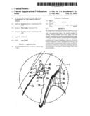 Ocular Collar Stent for Treating Narrowing of the Irideocorneal Angle diagram and image