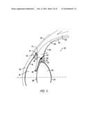 Ocular Collar Stent for Treating Narrowing of the Irideocorneal Angle diagram and image