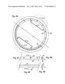 Ocular Collar Stent for Treating Narrowing of the Irideocorneal Angle diagram and image