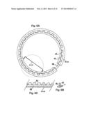 Ocular Collar Stent for Treating Narrowing of the Irideocorneal Angle diagram and image