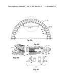 Ocular Collar Stent for Treating Narrowing of the Irideocorneal Angle diagram and image