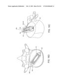 SPINAL IMPLANT AND INTEGRATION PLATE FOR OPTIMIZING VERTEBRAL ENDPLATE     CONTACT LOAD-BEARING EDGES diagram and image