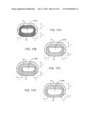 SPINAL IMPLANT AND INTEGRATION PLATE FOR OPTIMIZING VERTEBRAL ENDPLATE     CONTACT LOAD-BEARING EDGES diagram and image