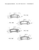 SPINAL IMPLANT AND INTEGRATION PLATE FOR OPTIMIZING VERTEBRAL ENDPLATE     CONTACT LOAD-BEARING EDGES diagram and image