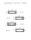 SPINAL IMPLANT AND INTEGRATION PLATE FOR OPTIMIZING VERTEBRAL ENDPLATE     CONTACT LOAD-BEARING EDGES diagram and image