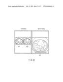 MEDICAL INFORMATION SYSTEM AND MEDICAL INFORMATION DISPLAY APPARATUS diagram and image