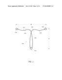 INTRAUTERINE CONTRACEPTIVE DEVICE diagram and image