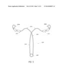 INTRAUTERINE CONTRACEPTIVE DEVICE diagram and image