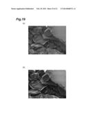 ULTRAVIOLET LIGHT GENERATING TARGET, ELECTRON-BEAM-EXCITED ULTRAVIOLET     LIGHT SOURCE, AND METHOD FOR PRODUCING ULTRAVIOLET LIGHT GENERATING     TARGET diagram and image