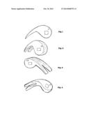 Roll Claw diagram and image