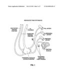 TARGETED DELIVERY OF BOTULINUM TOXIN TO THE SPHENOPALATINE GANGLION diagram and image