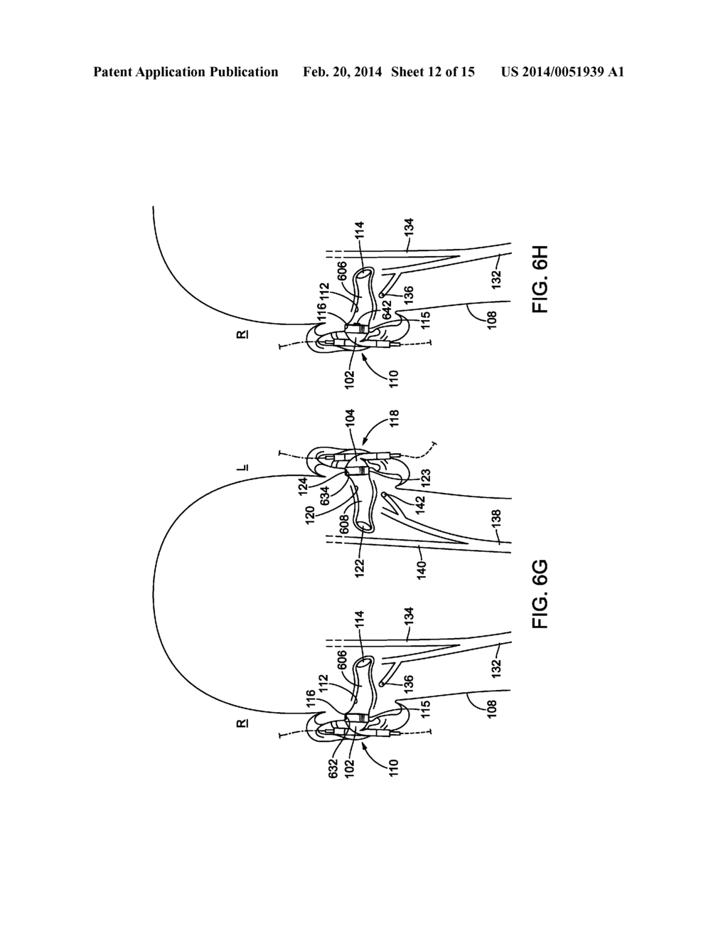 OBTAINING PHYSIOLOGICAL MEASUREMENTS USING EAR-LOCATED SENSORS - diagram, schematic, and image 13