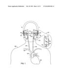 OBTAINING PHYSIOLOGICAL MEASUREMENTS USING EAR-LOCATED SENSORS diagram and image