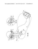 OBTAINING PHYSIOLOGICAL MEASUREMENTS USING EAR-LOCATED SENSORS diagram and image