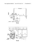 EXPANDED FREQUENCY ELECTROENCEPHALOGRAPHY/ELECTROCARDIOGRAPHY LIGHT     APPARATUS AND METHOD OF USE diagram and image