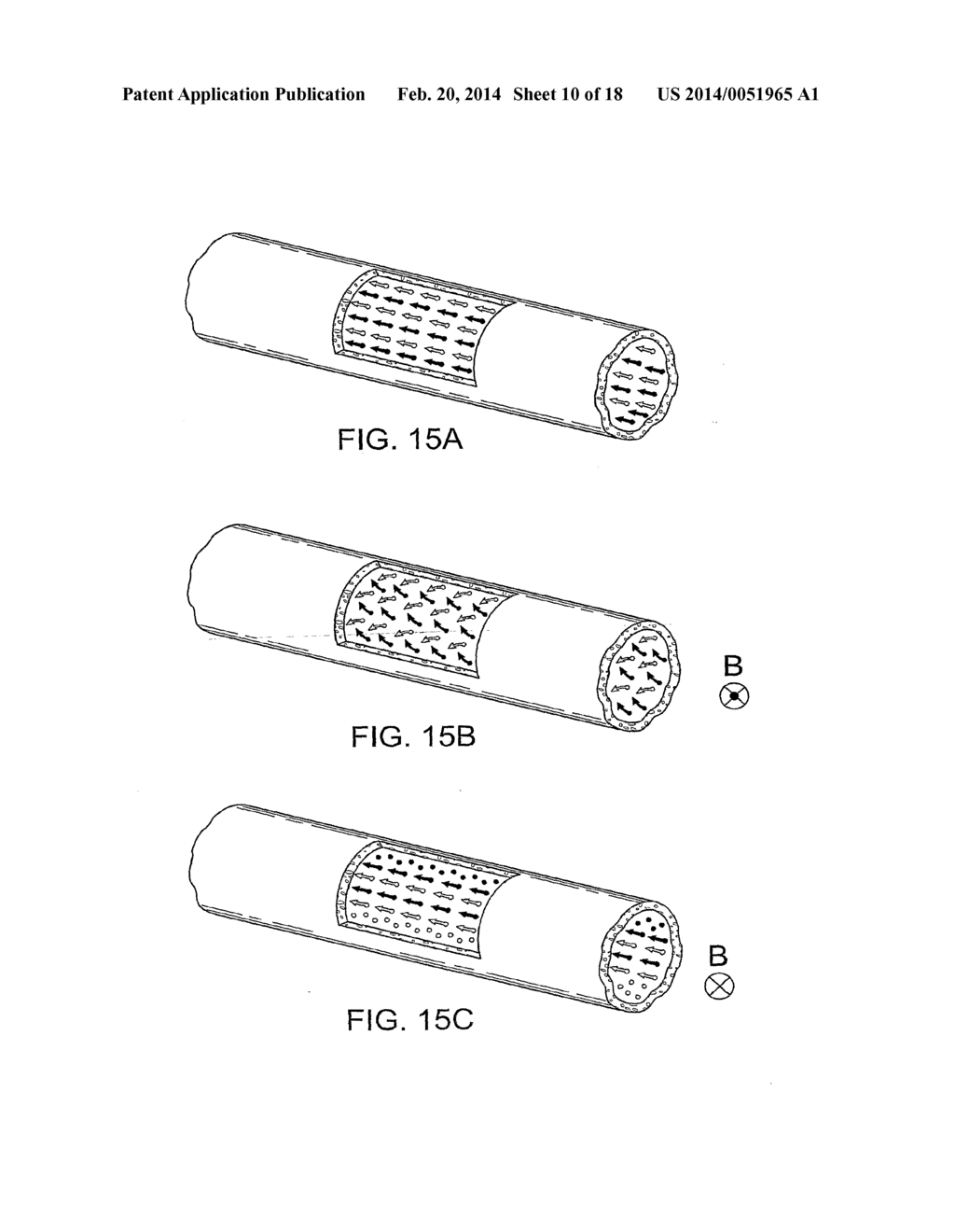 Implantable Zero-Wire Communications System - diagram, schematic, and image 11