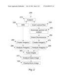 MRI IMAGING SYSTEM FOR GENERATING A RENDERED IMAGE diagram and image