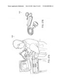 ULTRASOUND PROBE WITH INTEGRATED ELECTRONICS diagram and image