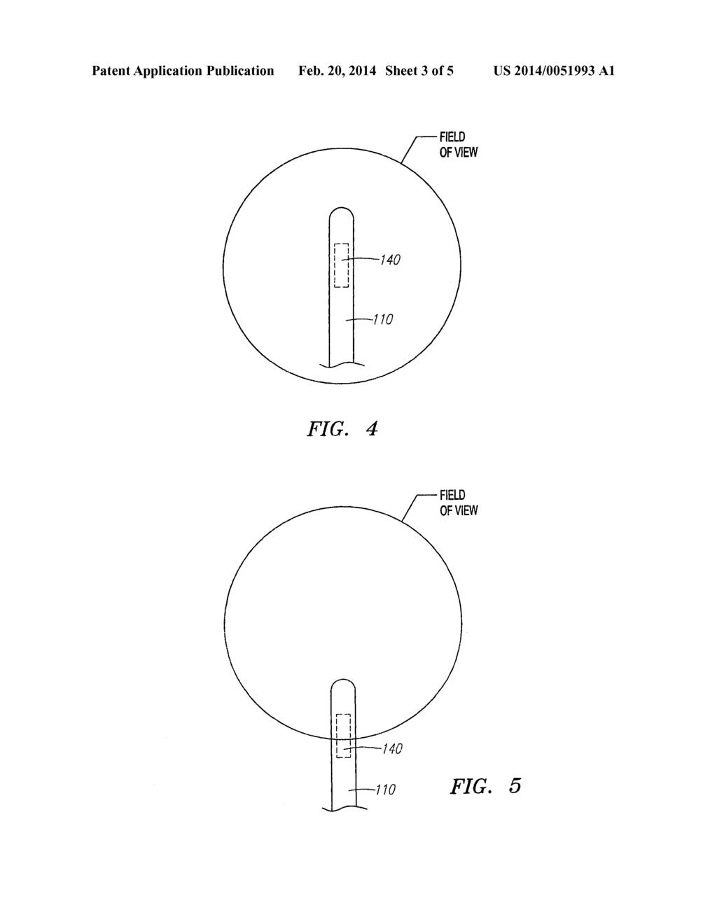 AUTOMATED ACTIVATION/DEACTIVATION OF IMAGING DEVICE BASED ON TRACKED     MEDICAL DEVICE POSITION - diagram, schematic, and image 04