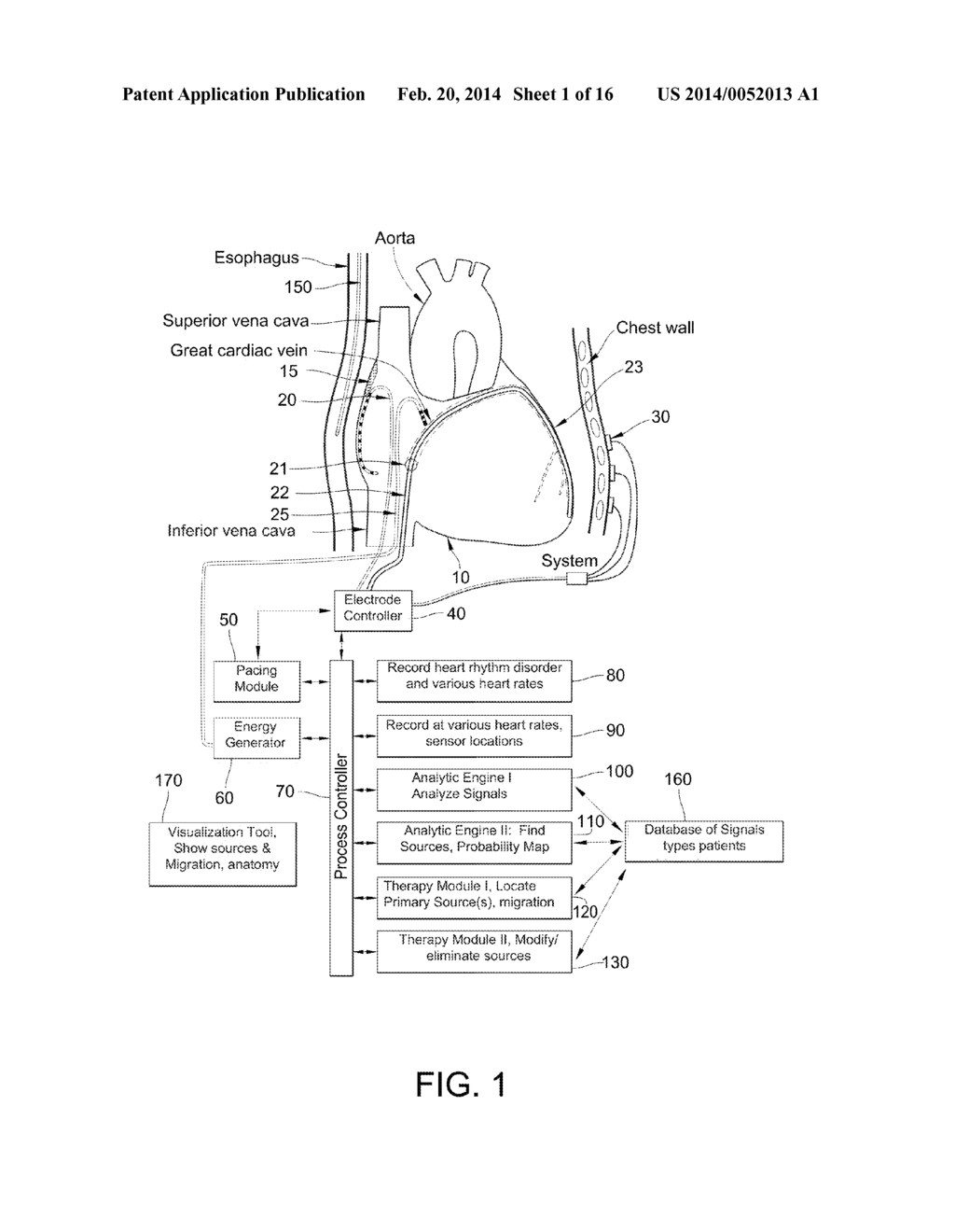 METHOD FOR ANALYSIS OF COMPLEX RHYTHM DISORDERS - diagram, schematic, and image 02