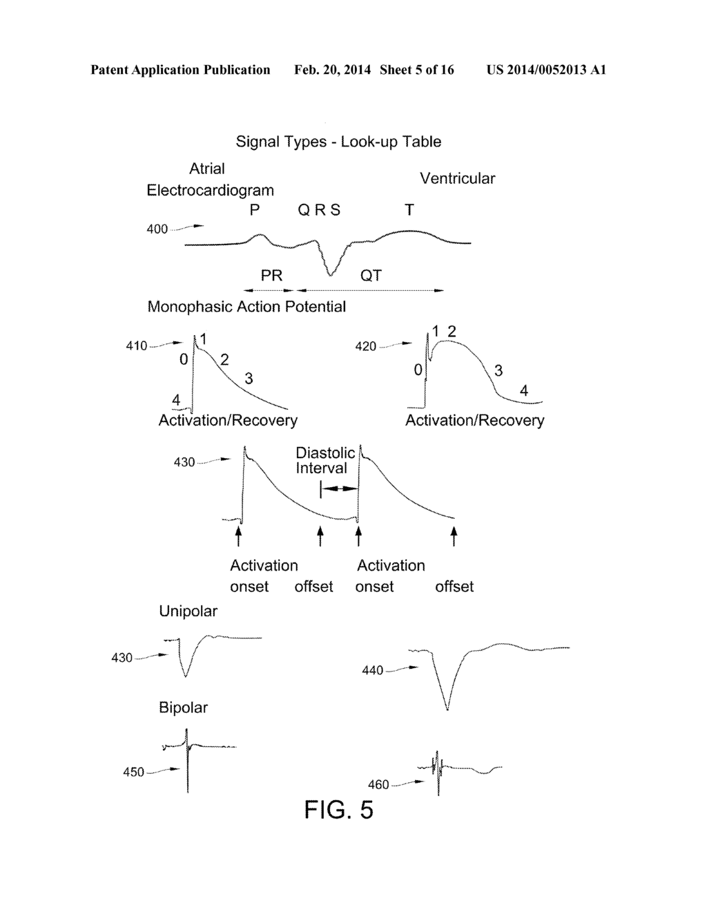 METHOD FOR ANALYSIS OF COMPLEX RHYTHM DISORDERS - diagram, schematic, and image 06