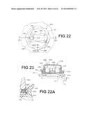 METHOD AND TOOLS FOR IMPLANTED DEVICE diagram and image