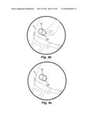 MODULAR SKIN-ADHERABLE SYSTEM FOR MEDICAL FLUID DELIVERY diagram and image