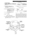 Injection Of Fibrin Sealant Including An Anesthetic In Spinal Applications diagram and image