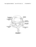 Injection Of Fibrin Sealant Including An Anesthetic In Spinal Applications diagram and image