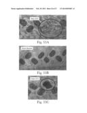 Web Material(s) For Absorbent Articles diagram and image